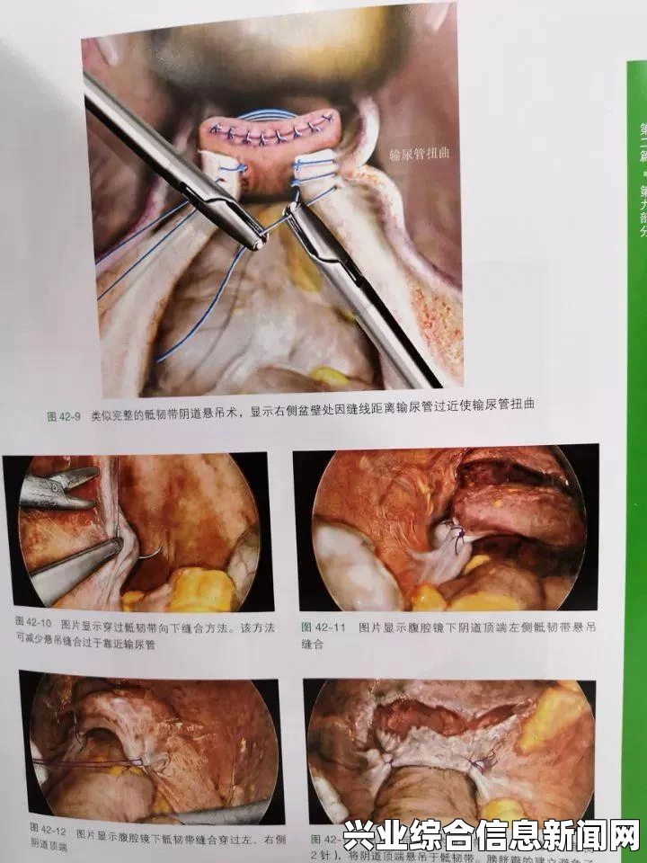 剑刃风暴，噩梦的官方配置指南与性能测试攻略详解