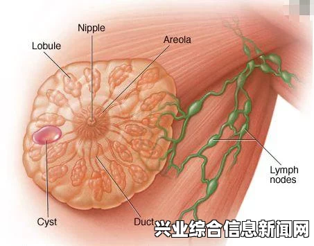 探寻乳腺结节的最佳治疗之道