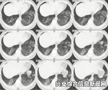 支原体肺炎症状全解析