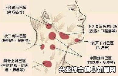 全面解析淋巴结肿大的相关用药指南及注意事项