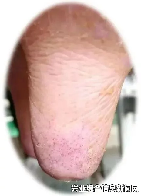 常见问题解决步骤